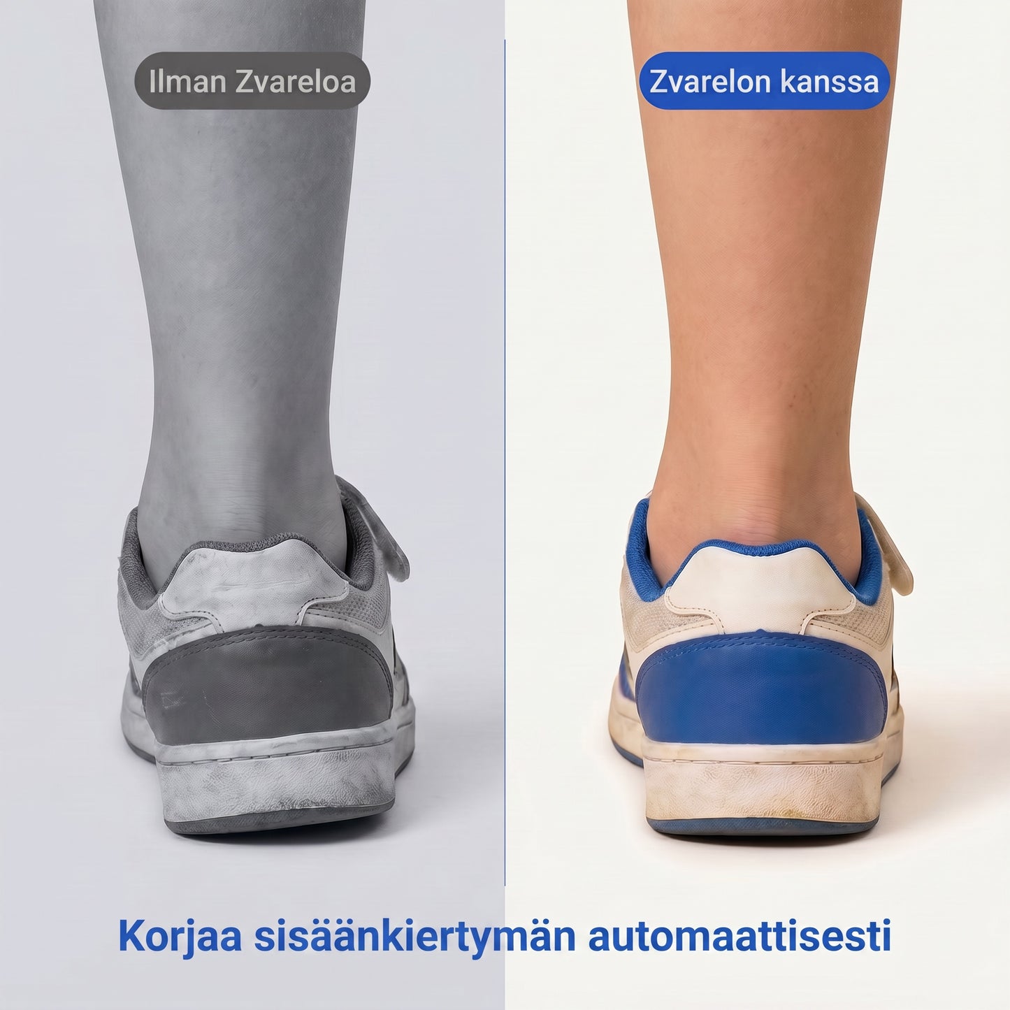 Zvarelo – Pohjalliset anatomisella holvituella ja syvällä kantakupilla