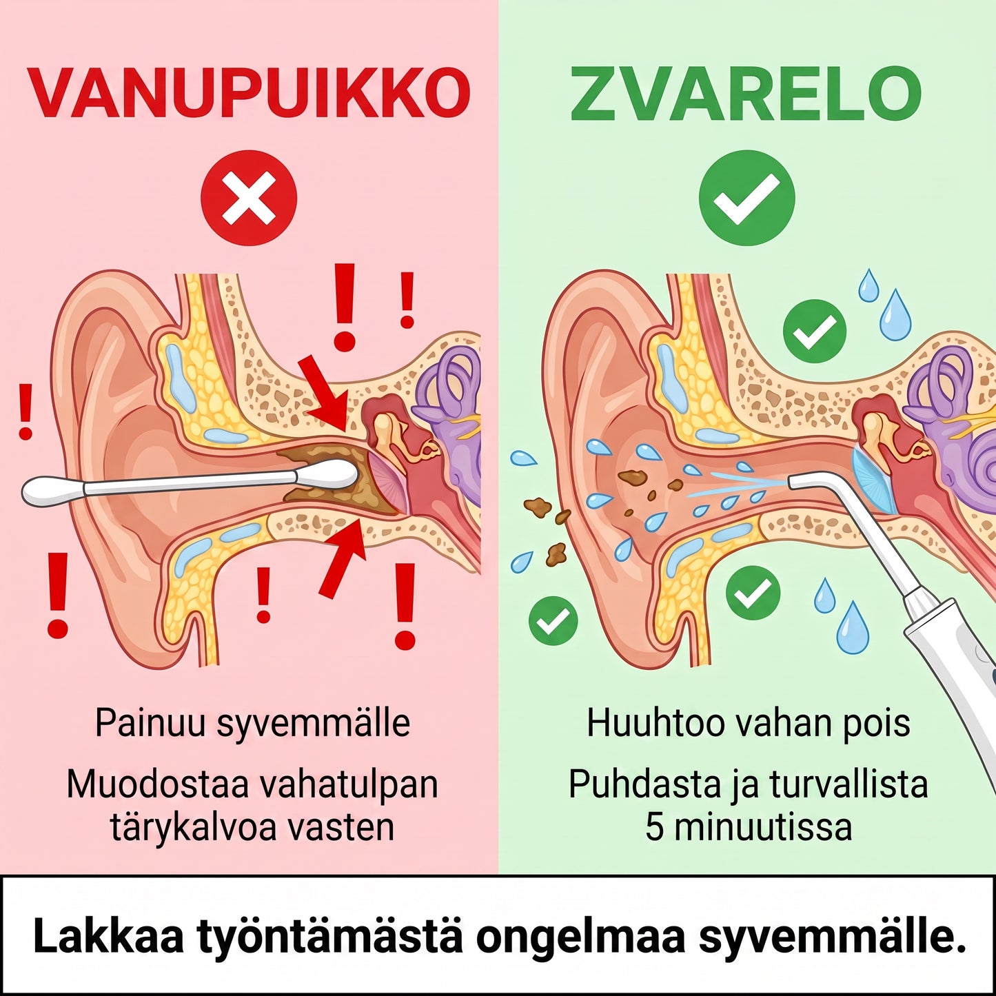 Zvarelo — Korvanpuhdistaja, joka poistaa vahatulpan kotona 3 minuutissa ilman pumpulipuikkoja tai klinikkakäyntiä