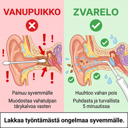 Zvarelo — Korvanpuhdistaja, joka poistaa vahatulpan kotona 3 minuutissa ilman pumpulipuikkoja tai klinikkakäyntiä